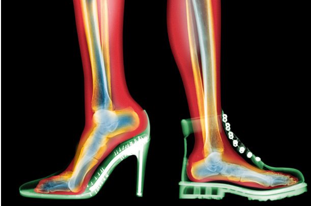 boots_xray