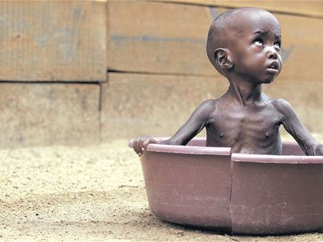 143628-hladomor-afrika-dieta-clanok