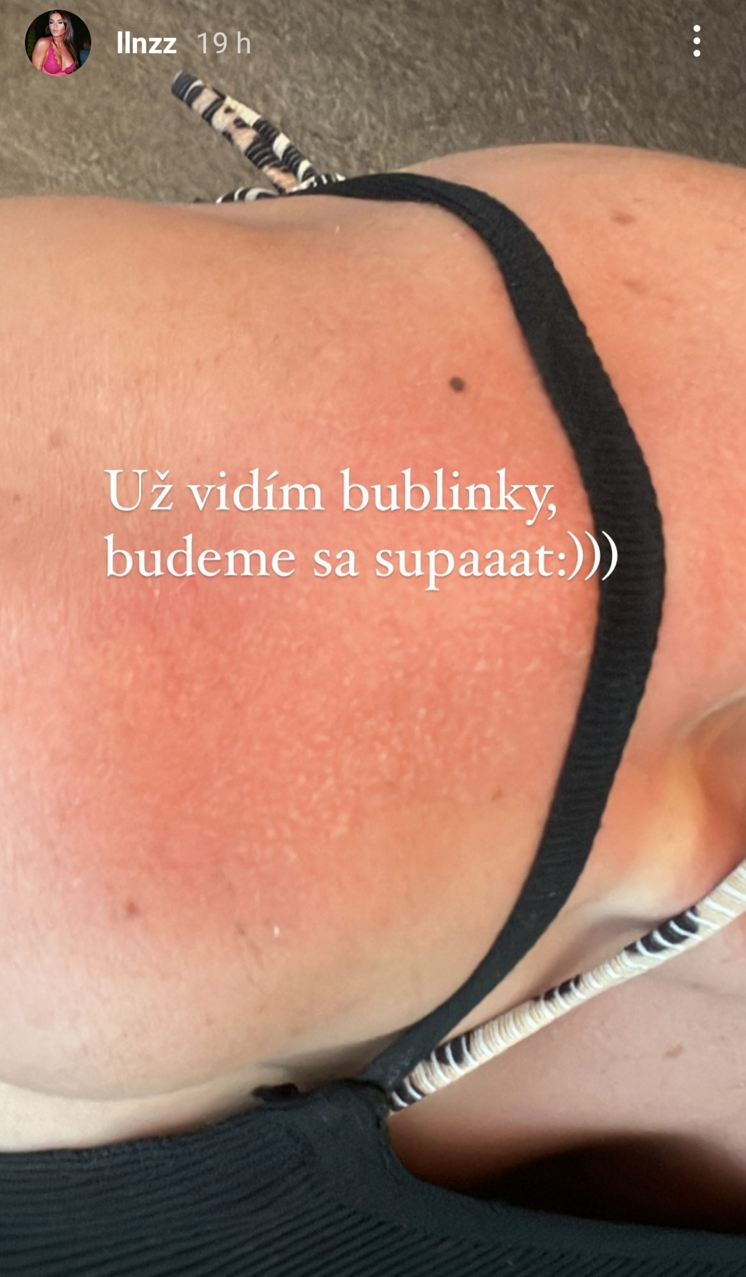 Lula sa spálila