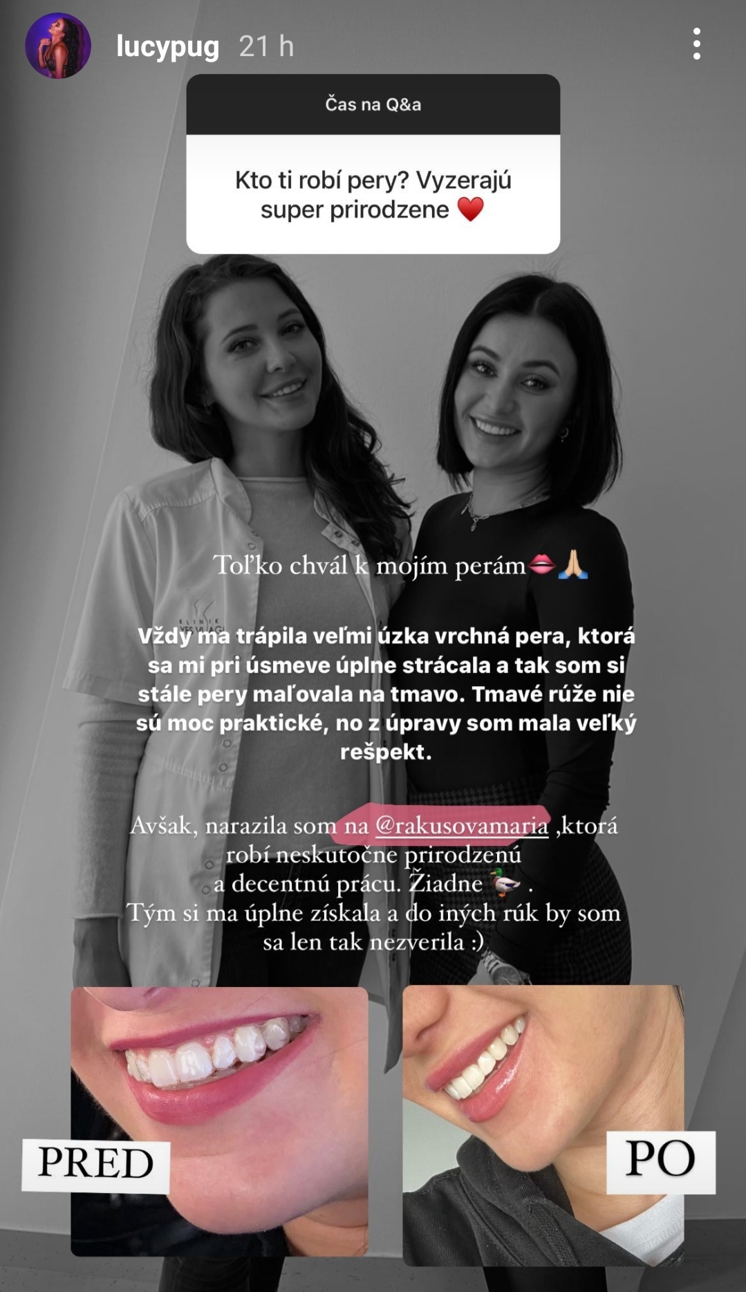Lucypug odpovede na otázky