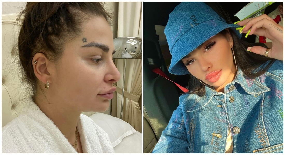 Zuzana Plačková ukázala plastiku