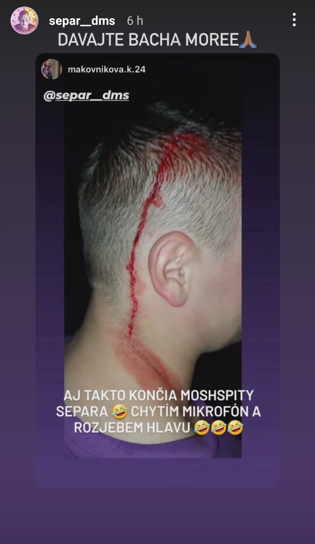 krvavý fanúšik