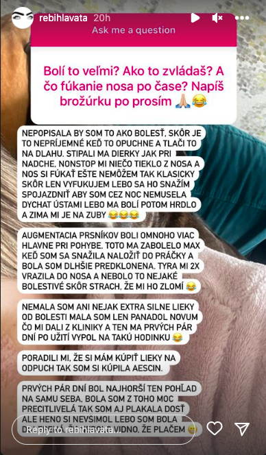 Rebeka plastika nosa