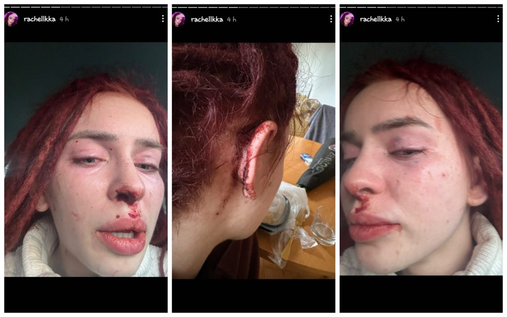 Influencerka Ráchel násilie