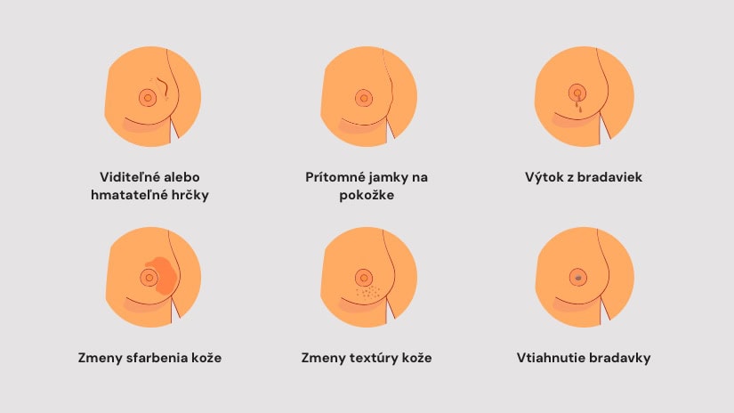 Slovenky sú majsterky Európy