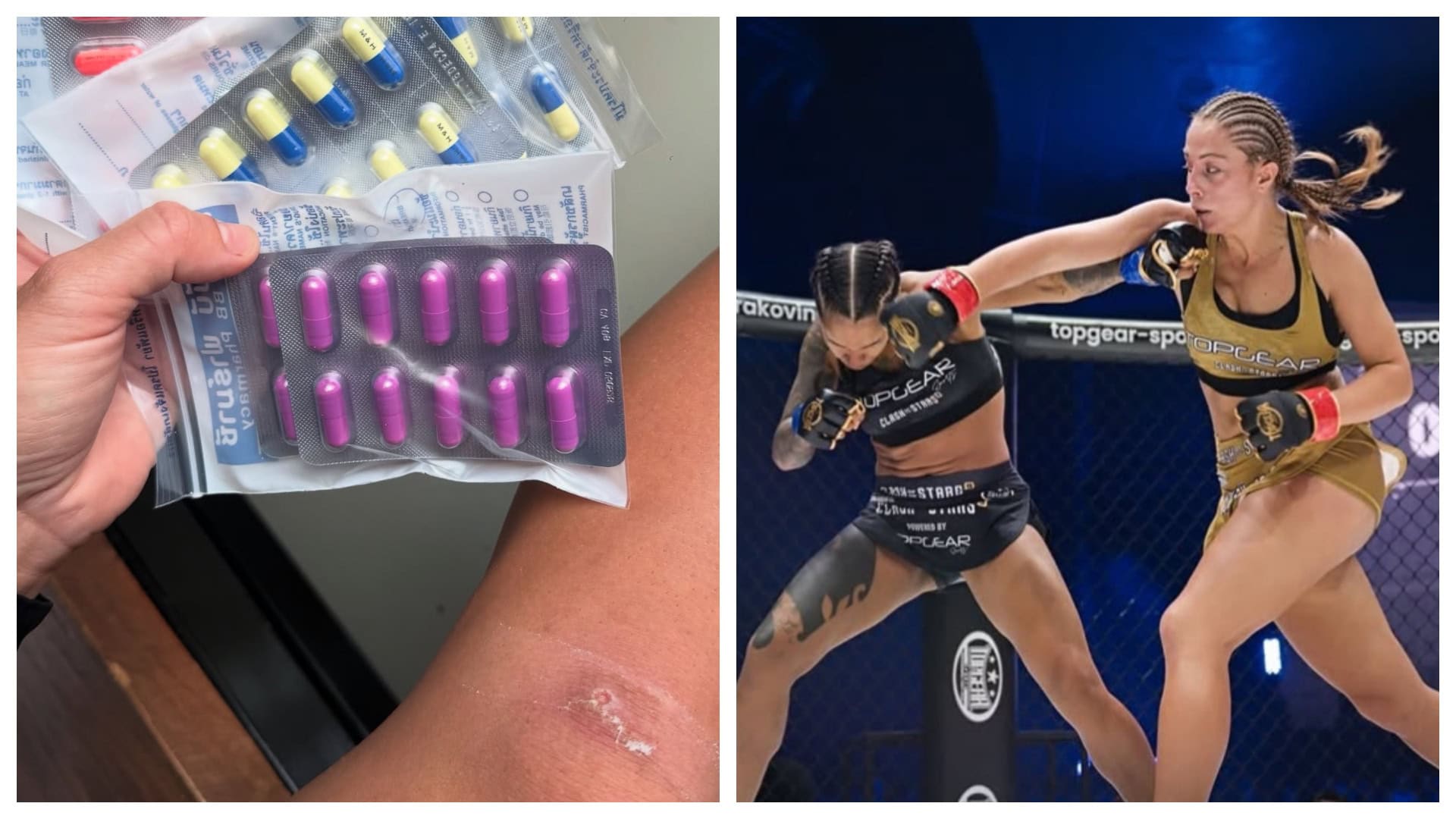 Športovkyňa Hanka Gelnarová čelí infekcii v Thajsku