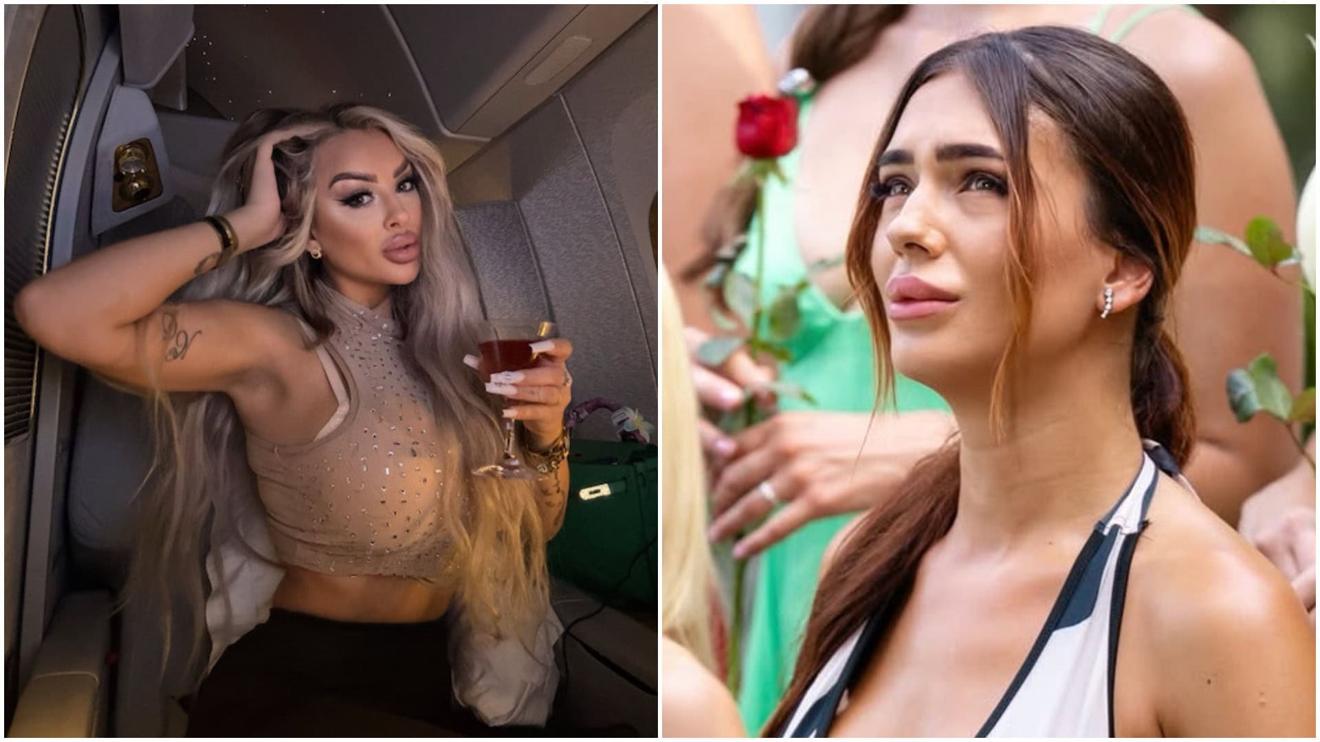Dolli prirovnávajú ku kontroverznej Miške