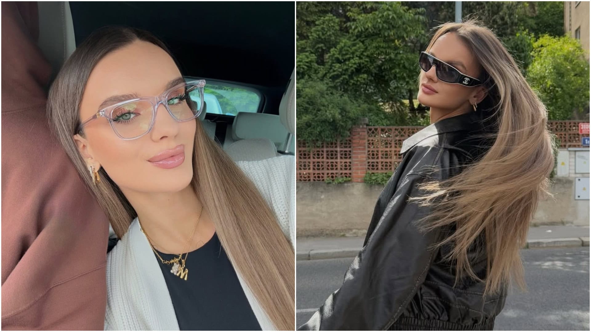 Kika z Love Island podstúpila operáciu: