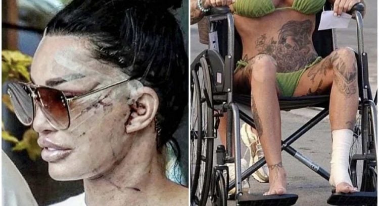 Známa moderátorka prišla o všetko: Teraz bojuje s alopeciou a finančnými problémami