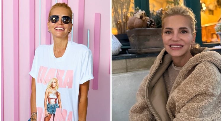 Dara Rolins prvýkrát prehovorila o kritizovanom facelifte