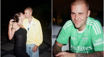 Justin Bieber utrpel nepríjemný úraz