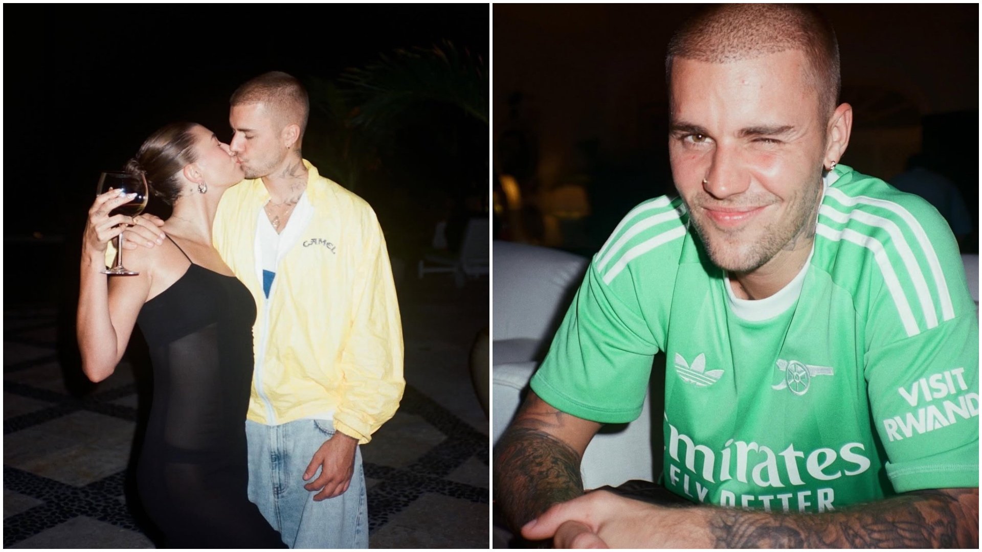 Justin Bieber utrpel nepríjemný úraz