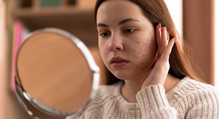 Starostlivosť o pleť, ktorá má negatívny dopad na tvoju tvár