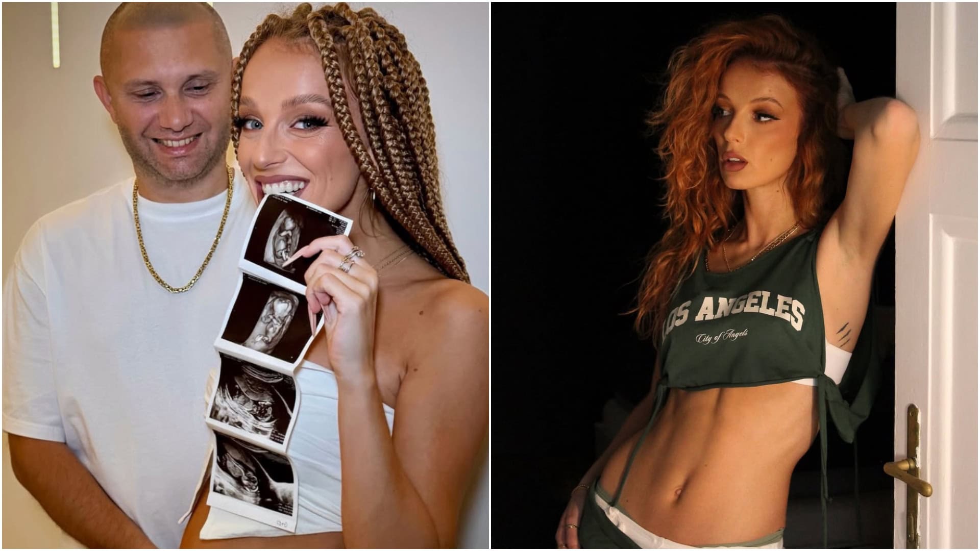 SIMA otvorene o prvých reakciách na tehotenstvo