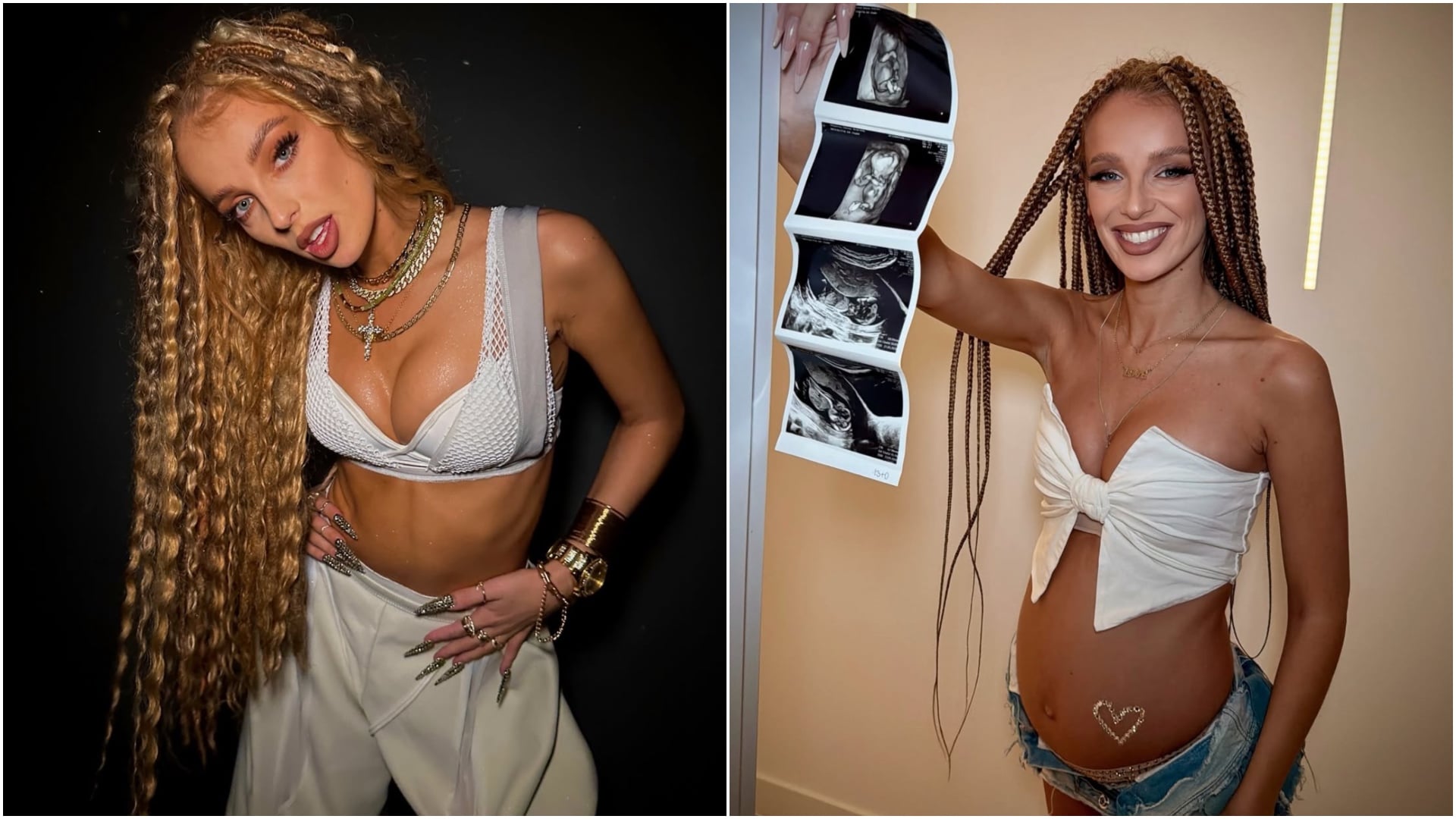 SIMA prekvapila oznámením tehotenstva