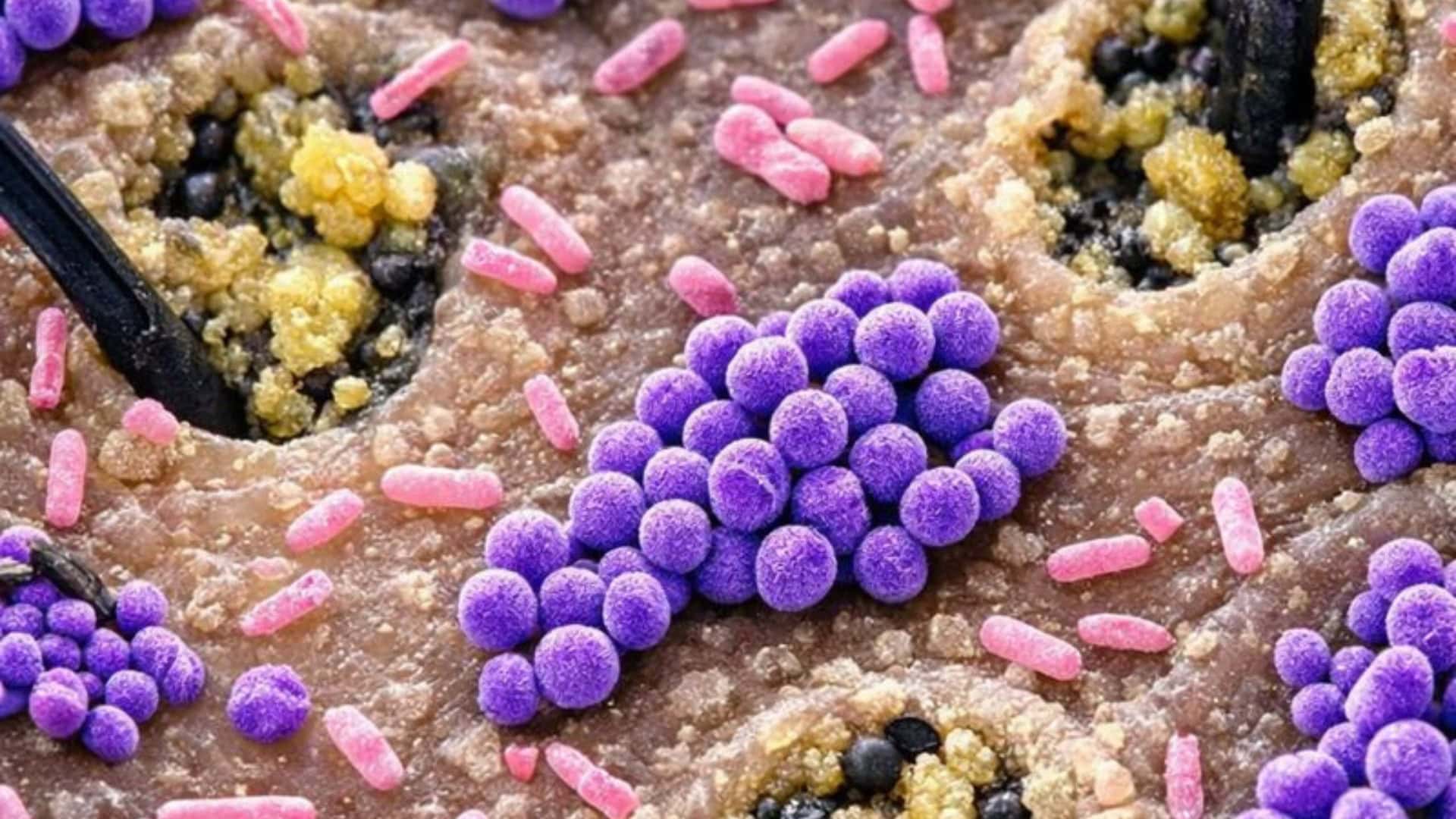 Používaš uterák? Takto svoju starostlivosť o pokožku sabotuješ