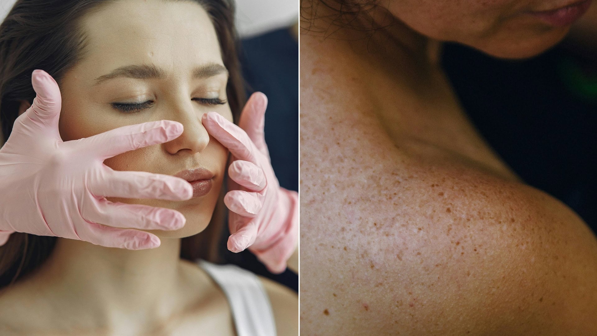 Používaš uterák? Takto svoju starostlivosť o pokožku sabotuješ