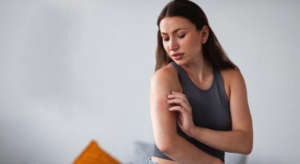 Ekzém, ktorý svrbí: Vyskúšaj tieto domáce toniká od starej mamy