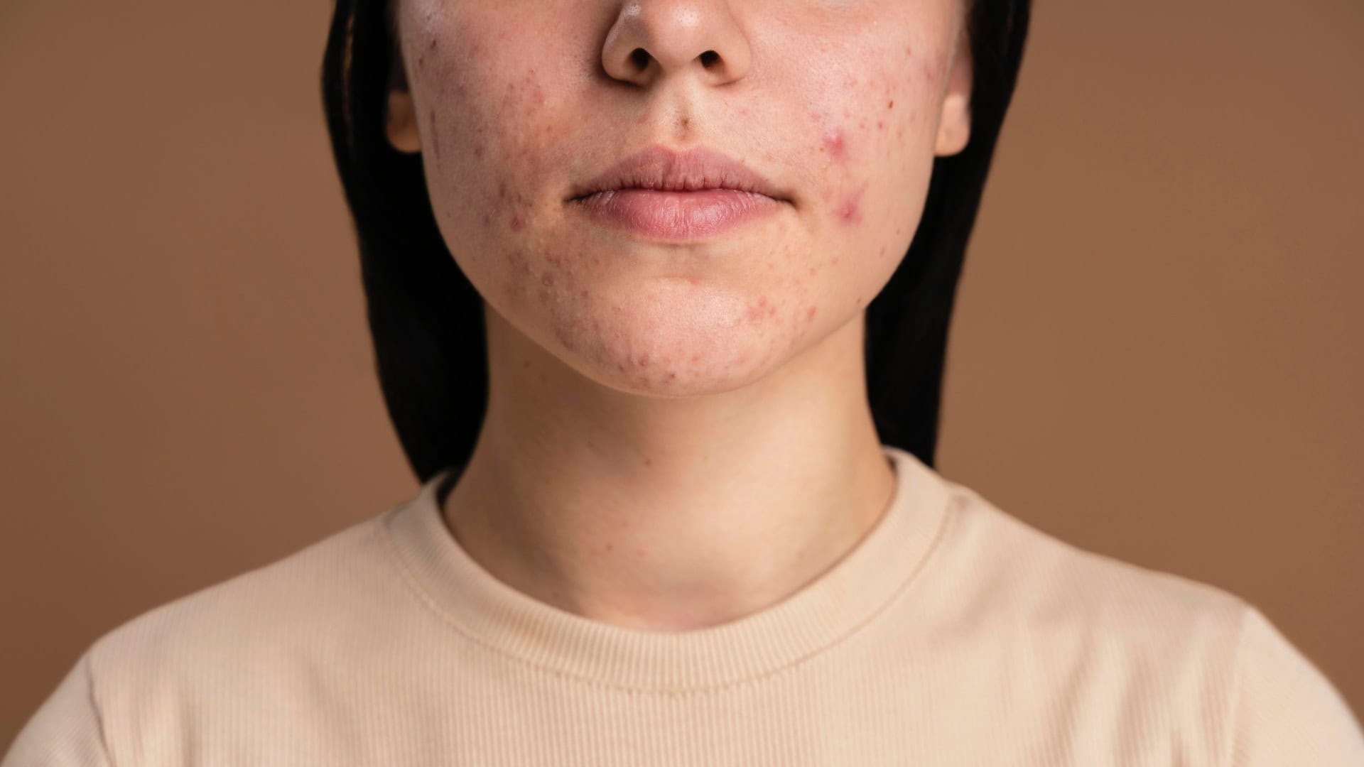 7 skrytých príznakov intolerancie na lepok