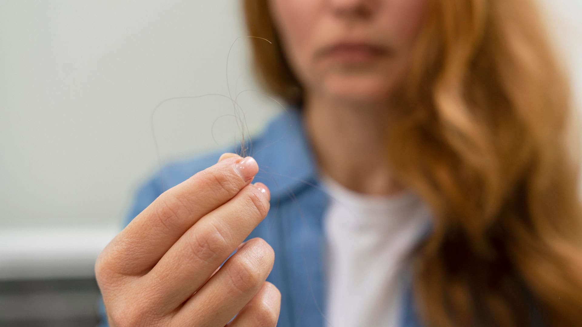 Vypadávanie vlasov: 5 signálov, že ti zlyháva dôležitý orgán