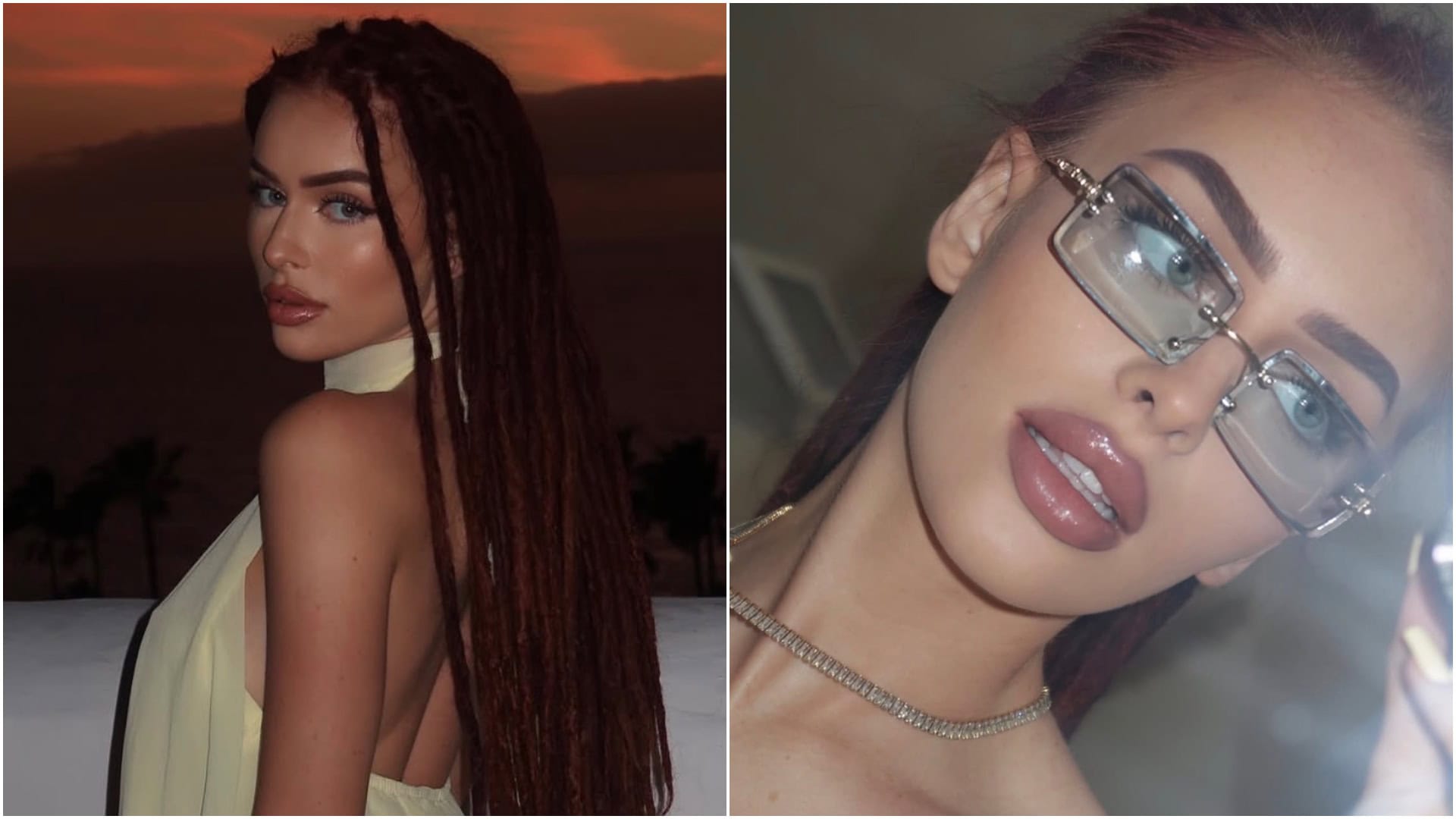 Je Rachellkka tehotná?