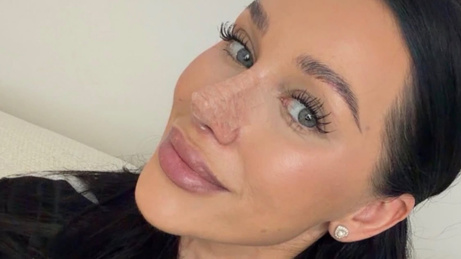 Bianka Rumanová ukázala nový nos