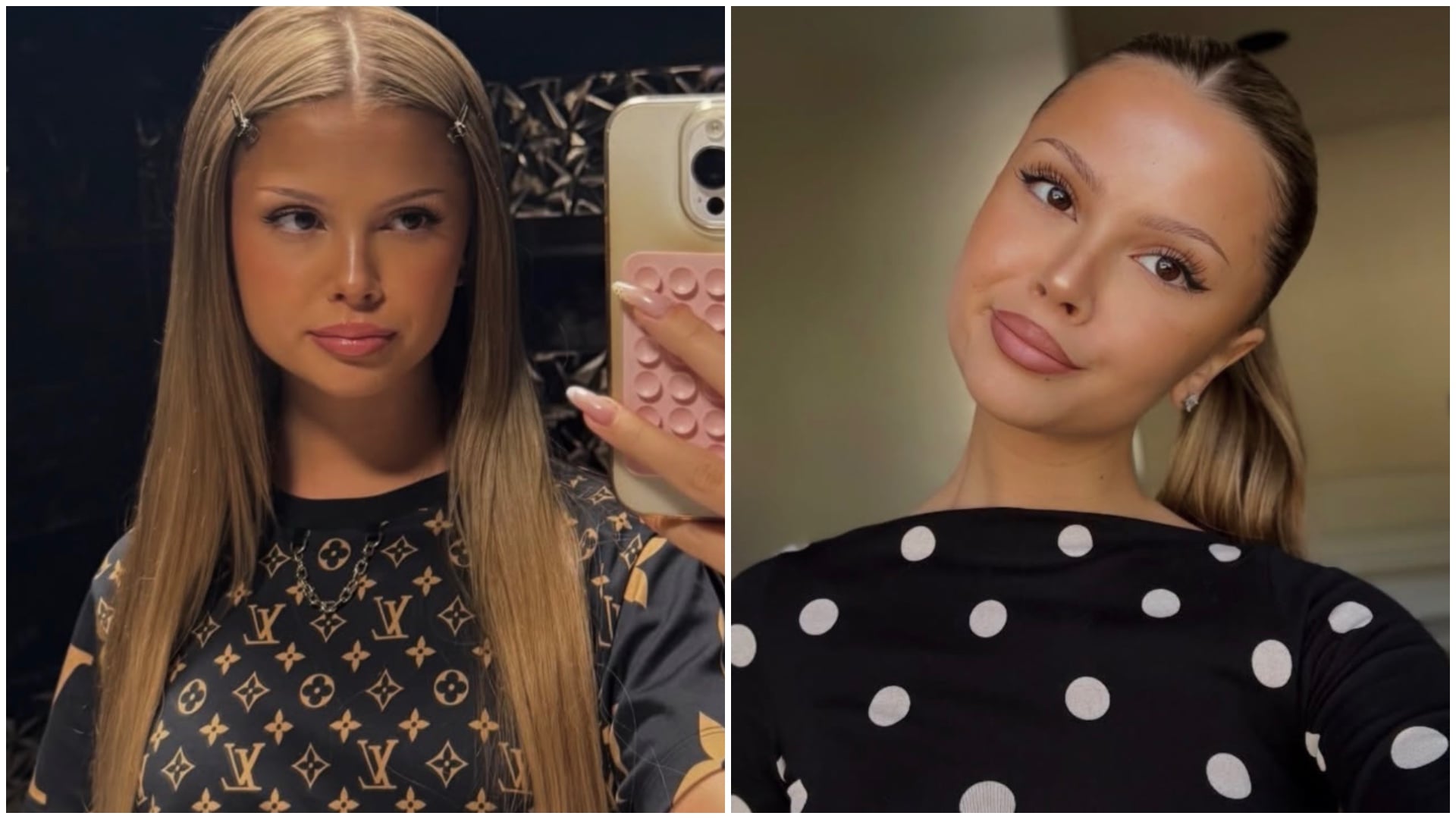 Chiara Fujaková prehovorila po vlne hejtu